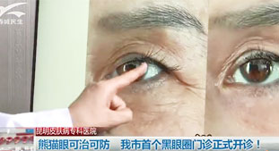 熊貓眼可治可防，我市黑眼圈門診正式開診!