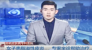 女子患脂溢性皮炎 專家坐診幫助治療