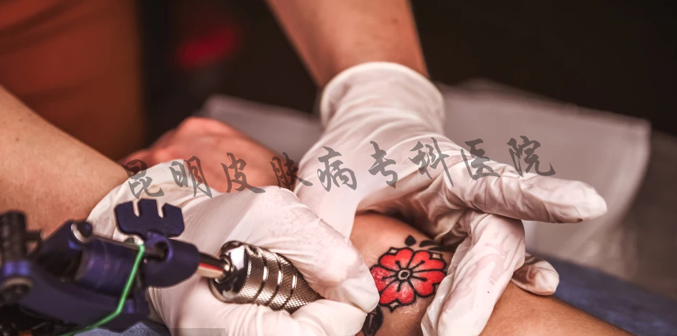 治療紋身的疤痕去哪里