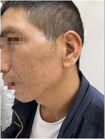 疤痕專科正規(guī)昆明