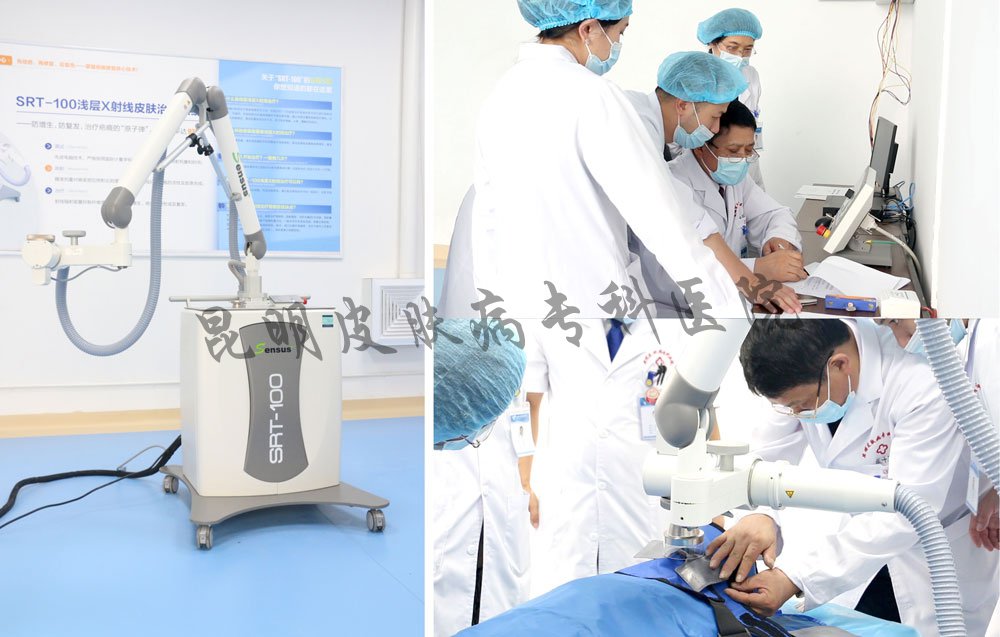 什么儀器治療疤痕最厲害