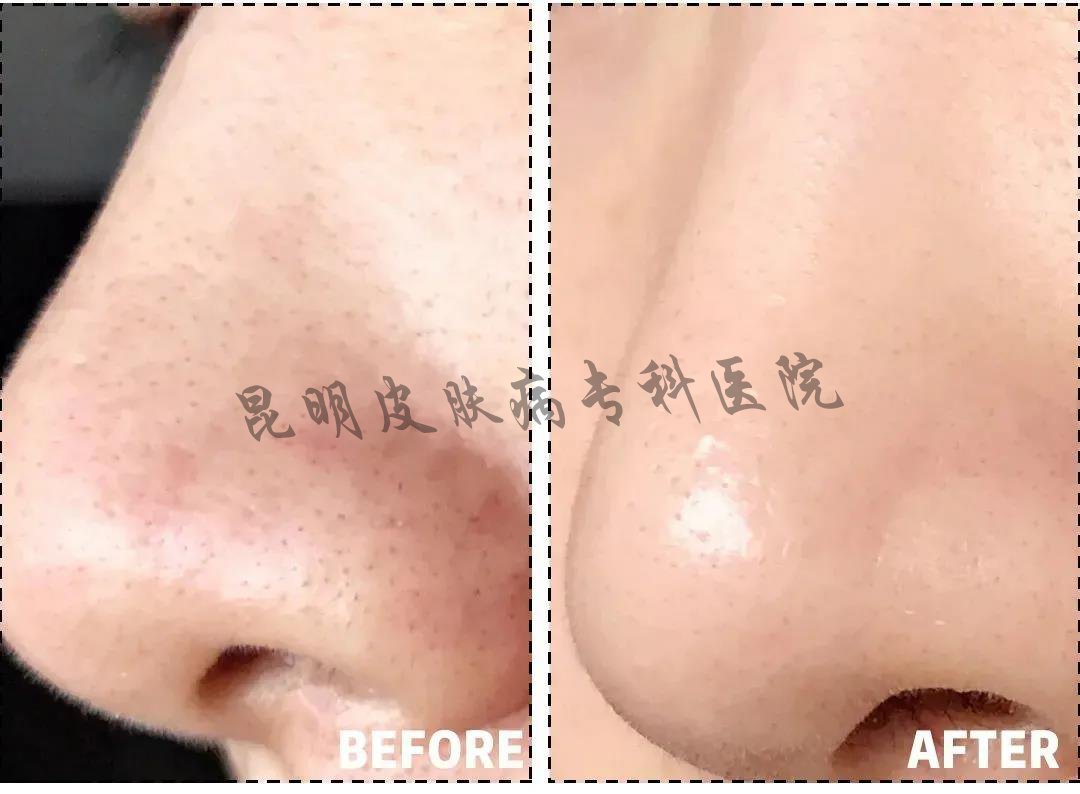昆明看疤痕病的醫(yī)院