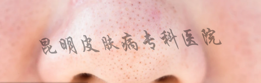 黑頭粉刺.png