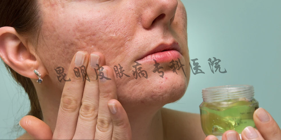 疤痕增生可以預(yù)防嗎