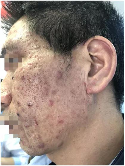 昆明誰家疤痕病醫(yī)院好