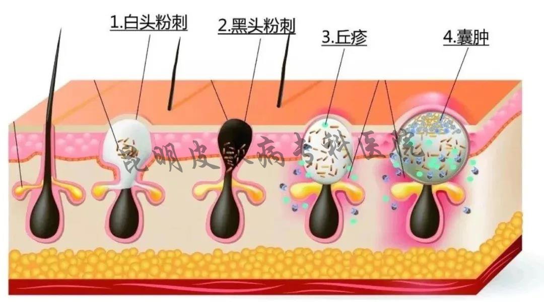 昆明哪家醫(yī)院看疤痕病看的好