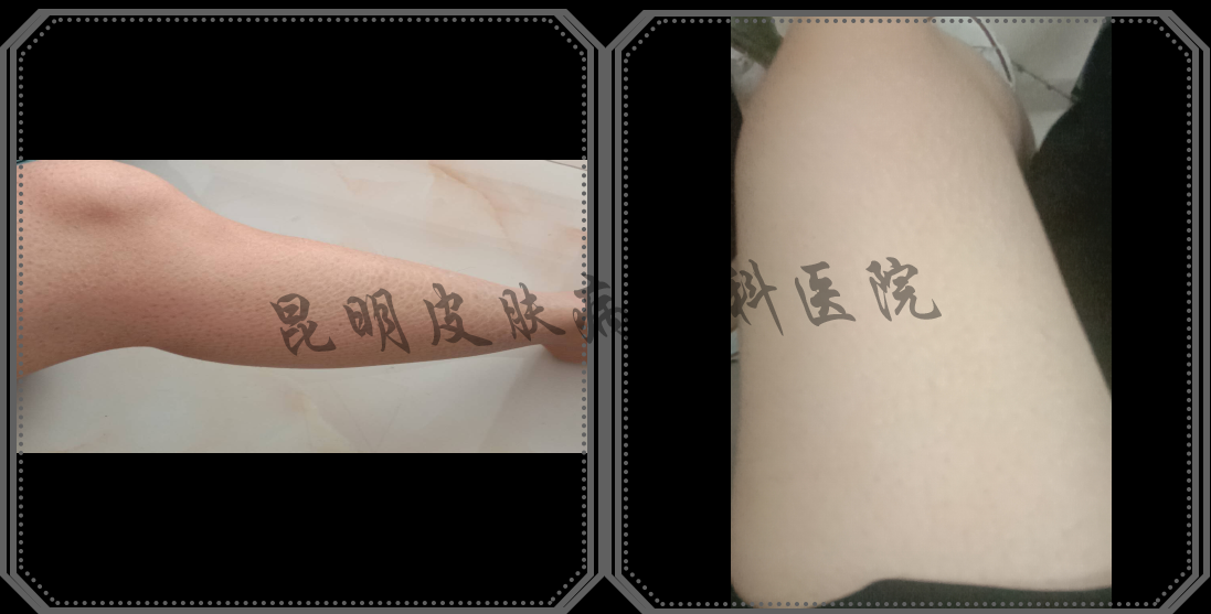 灰色方形商務(wù)邊框-恢復(fù)的.png