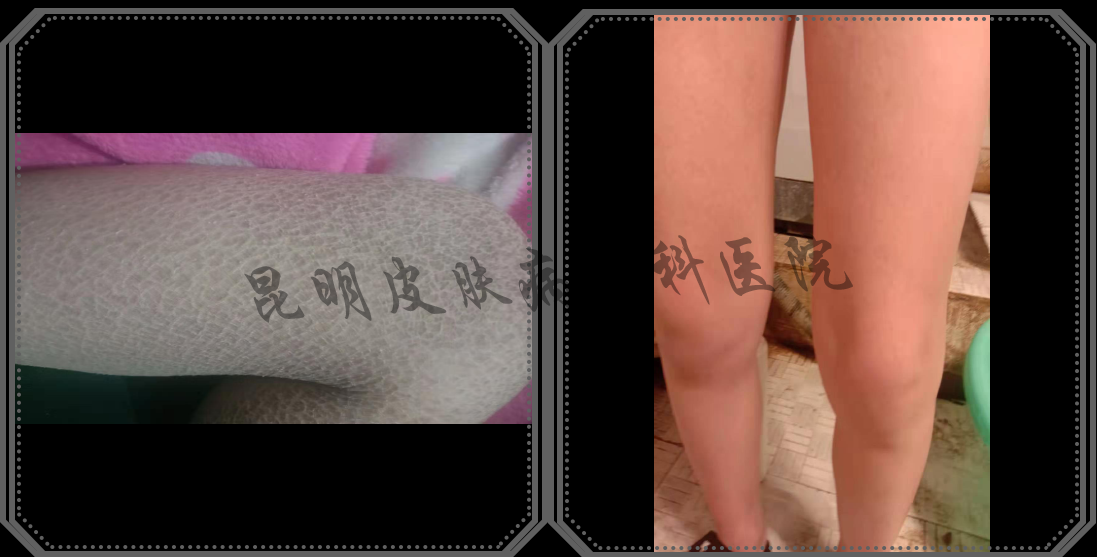 灰色方形商務(wù)邊框-恢復(fù)的.png